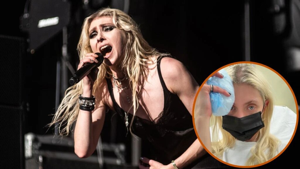 Taylor Momsen, do The Pretty Reckless, é hospitalizada após picada de aranha